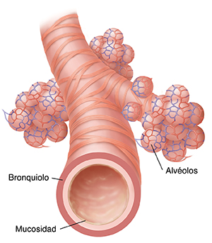 Primer plano de un bronquio y un alvéolo.