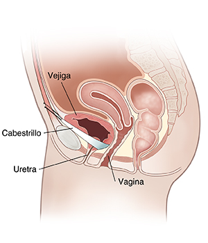 Vista lateral de corte transversal de la pelvis femenina donde se observa el cabestrillo pubovaginal.